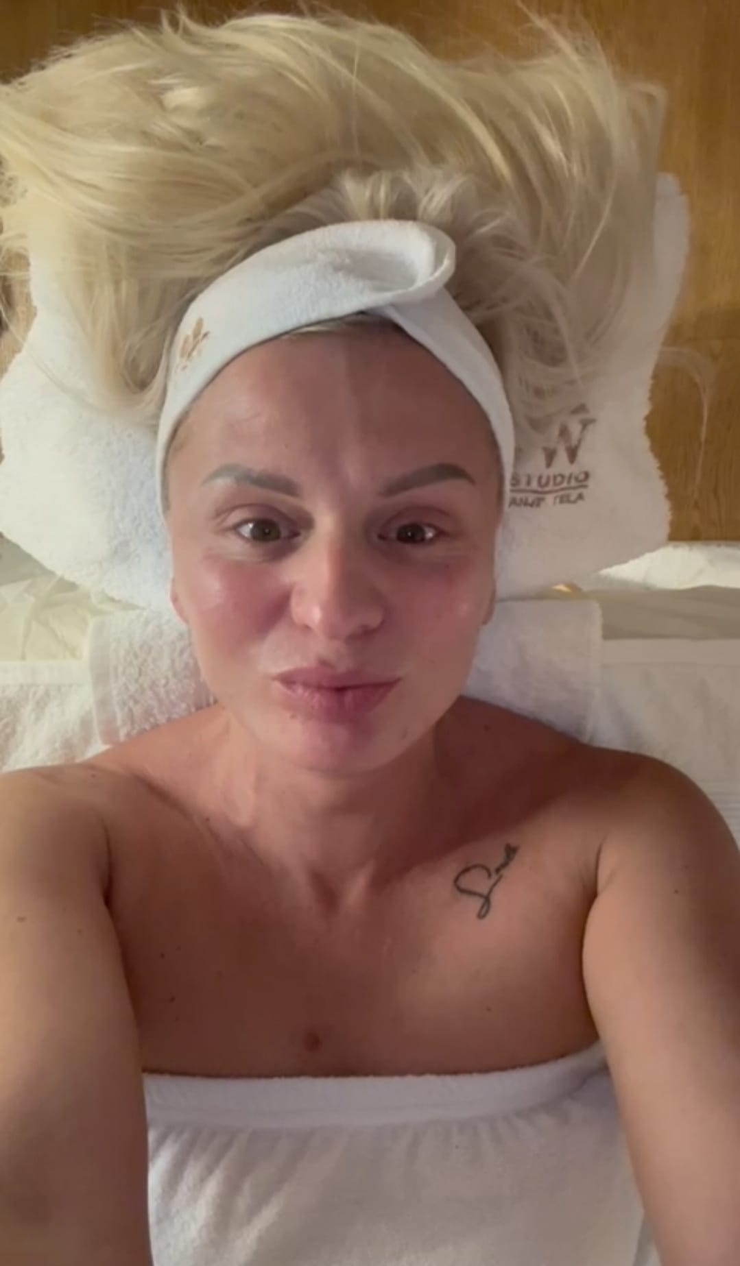 Plava klijentkinja nakon microneedling tretmana, sa karakterističnim crvenilom i svilenim sjajem kože na celom licu.